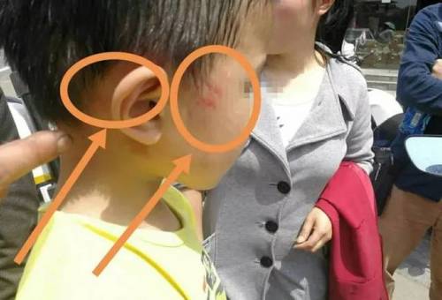 第181页